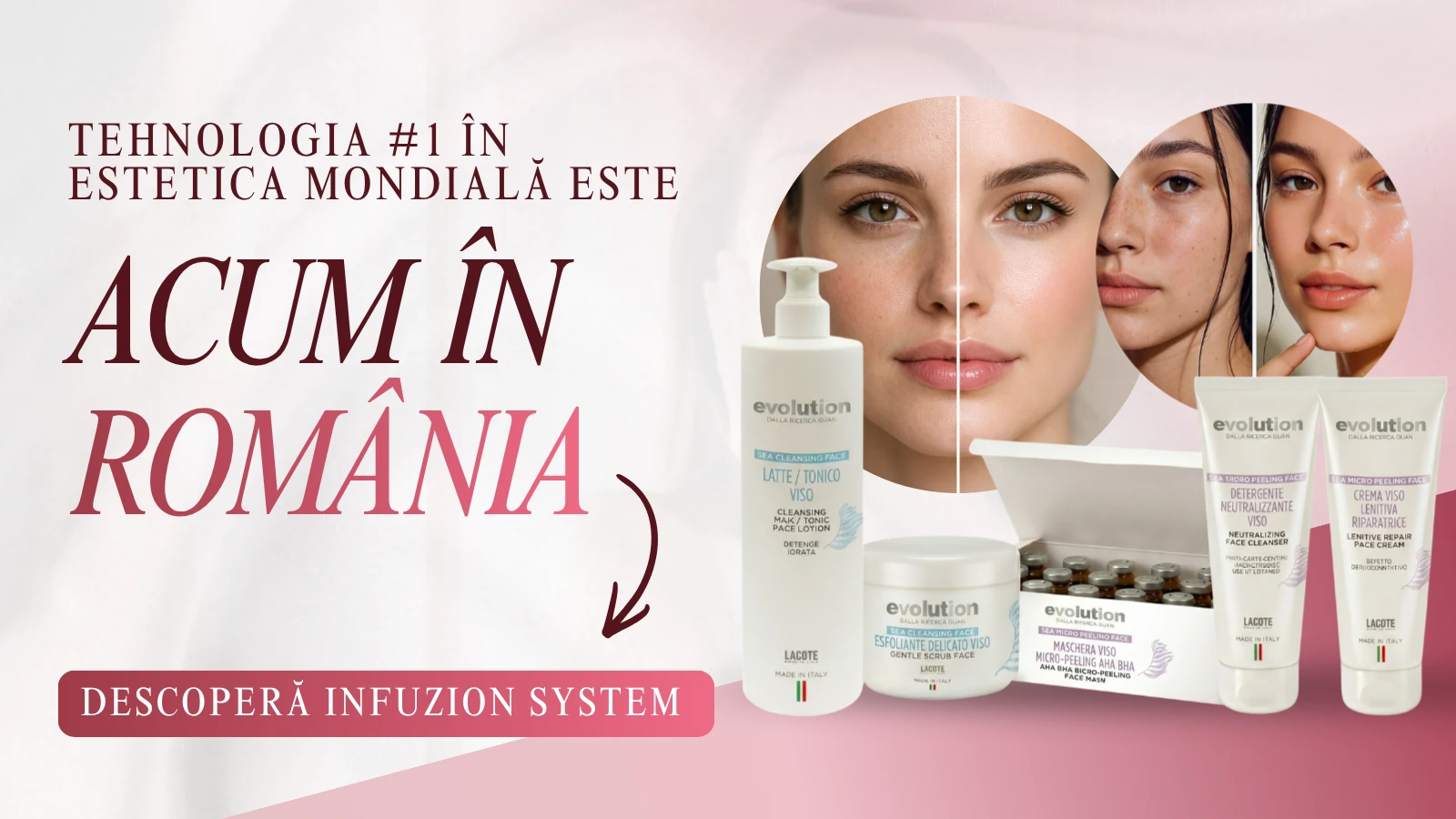 Prezentare Infuzion System